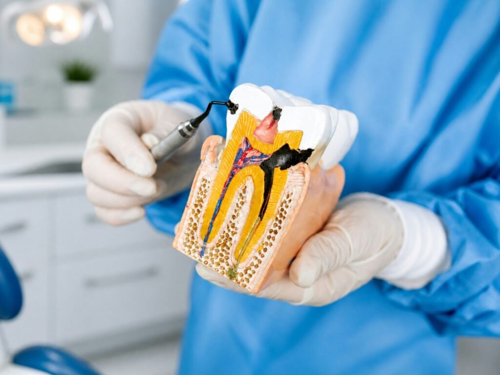 Single Sitting Root Canal Treatment