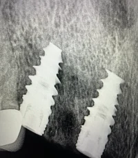 two dental implants adjacent natural tooth xray